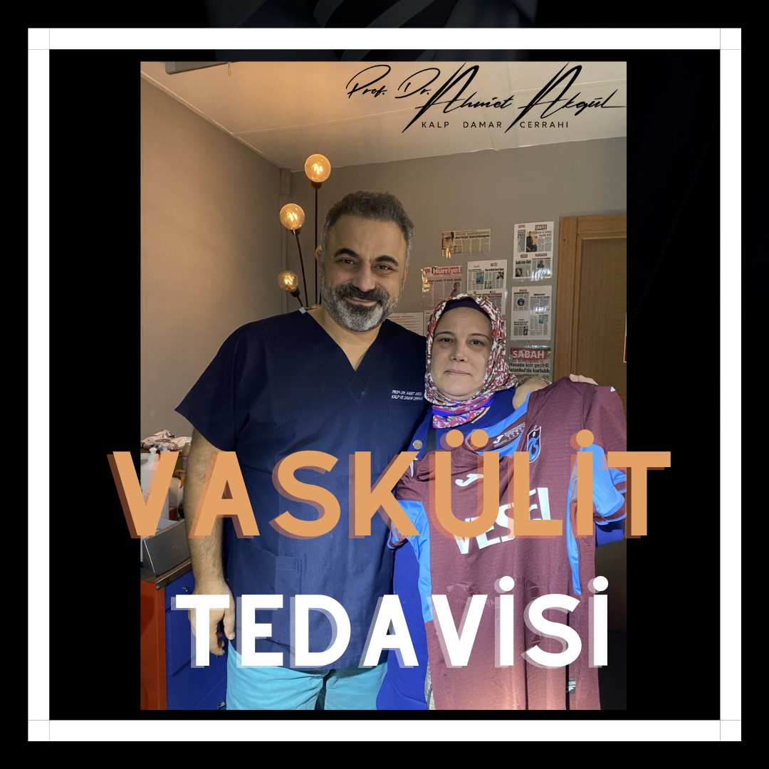 Vaskülit tedavisinde en yeni teknikler